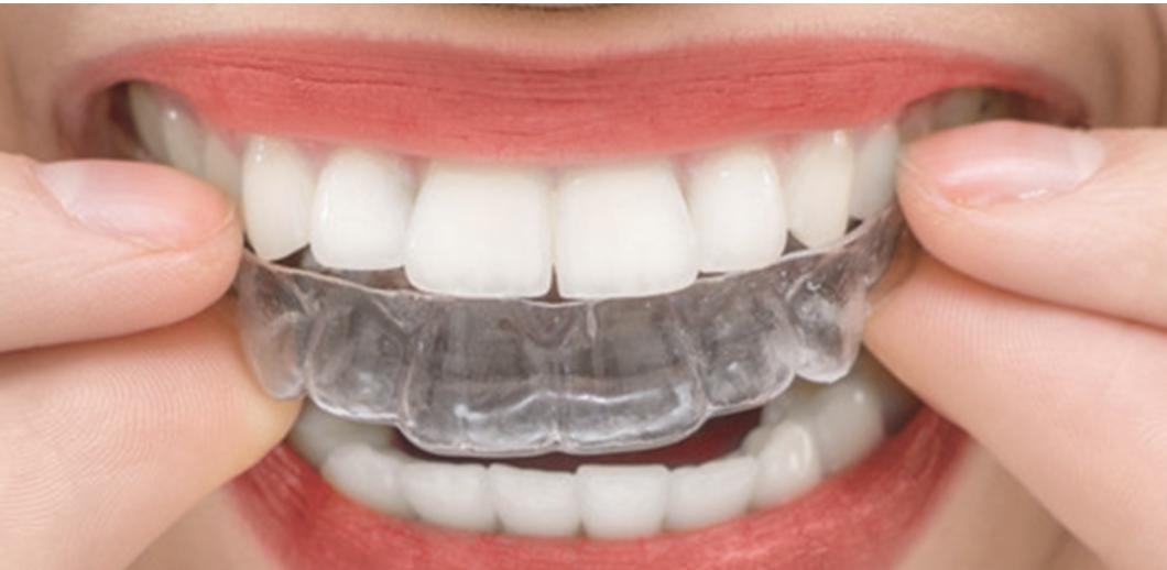 Clínica Dental Carmen Díaz — imagen 5